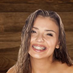 Adult,Teen and Traditional Braces at James W. May DDS, PC