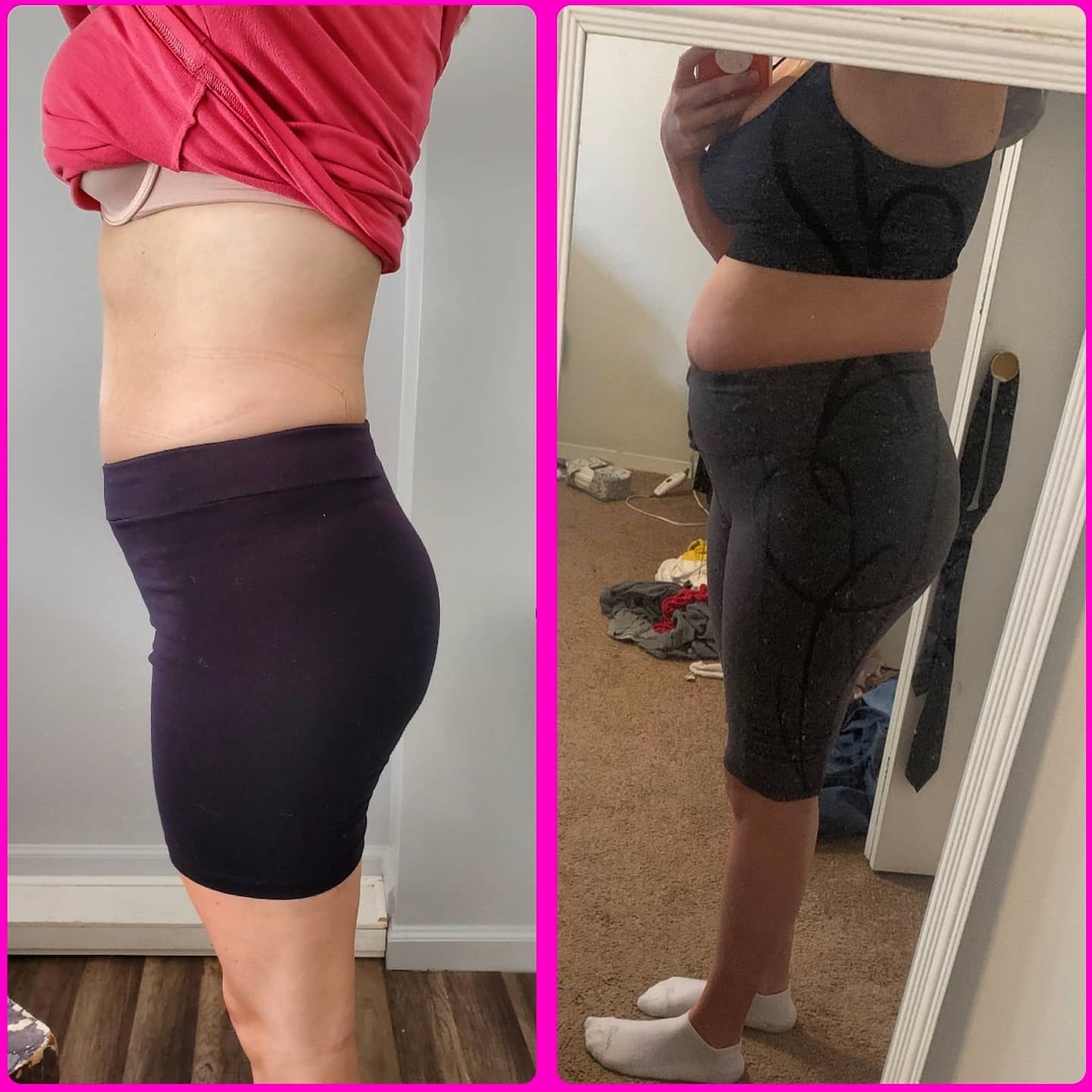 Cryo Toning Body before-after