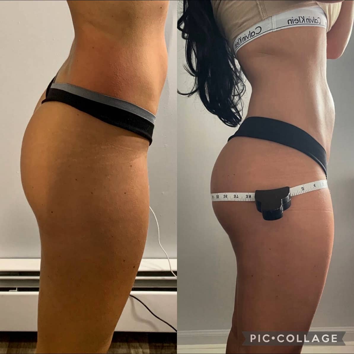 Body treatment before-after