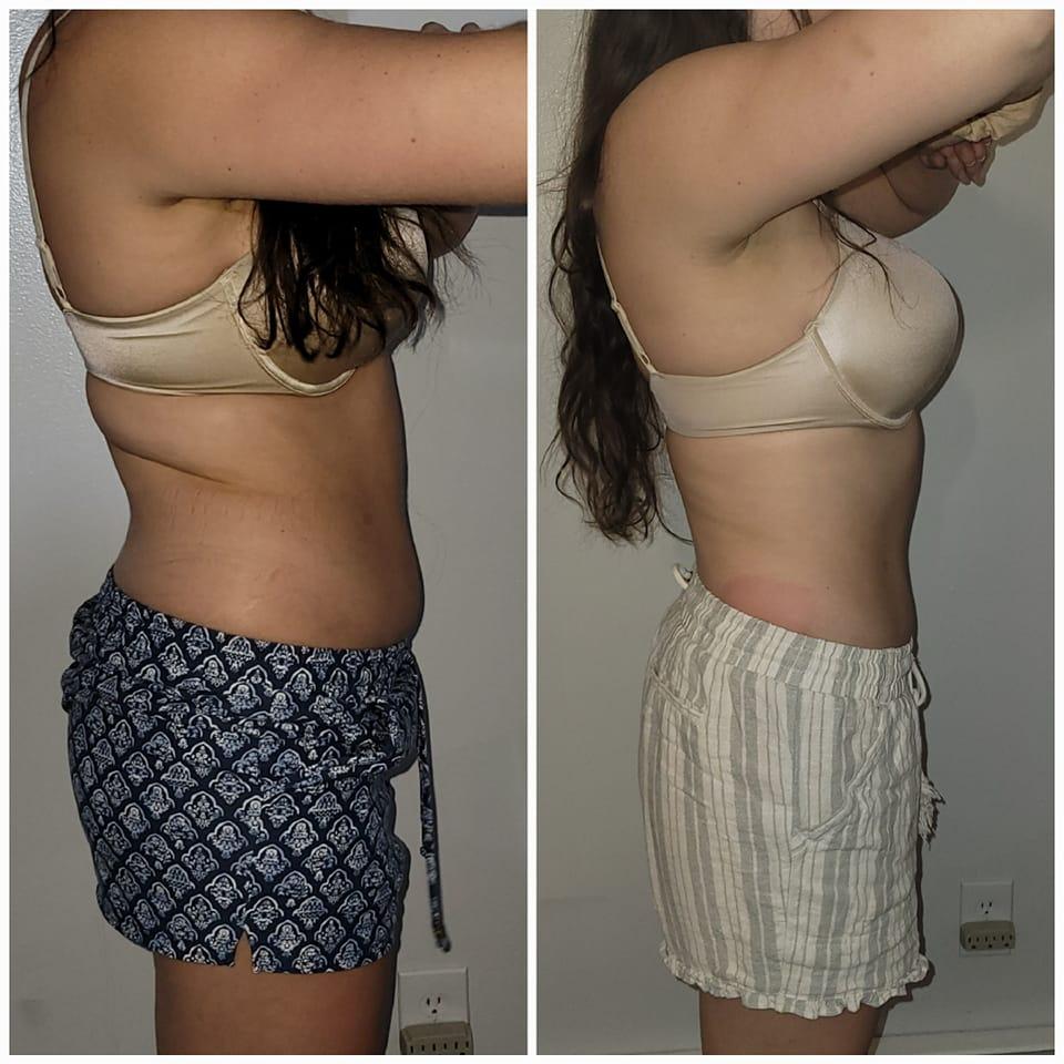 Body treatment before-after