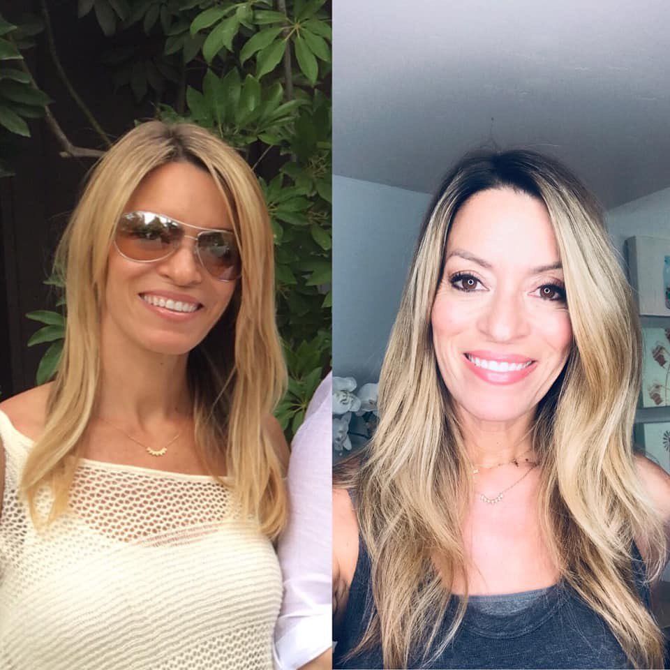 hair treatment before-after