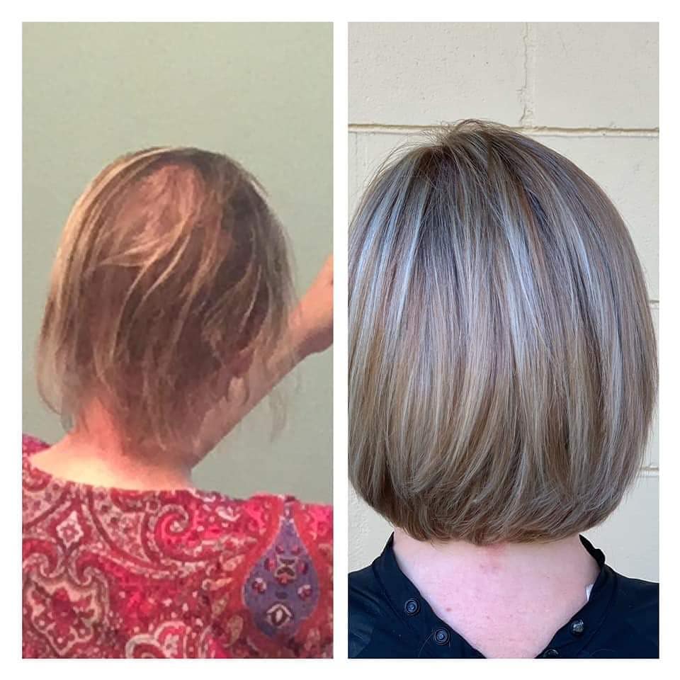 scalp therapy before-after