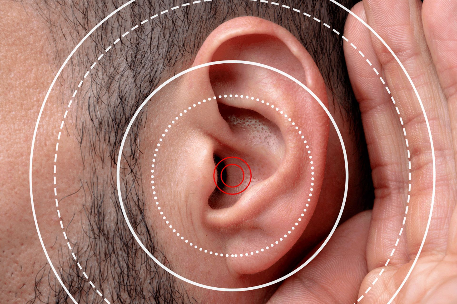 Valutazione udito online