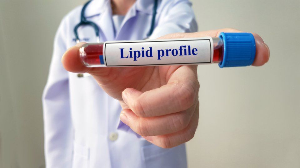 profilo lipidico