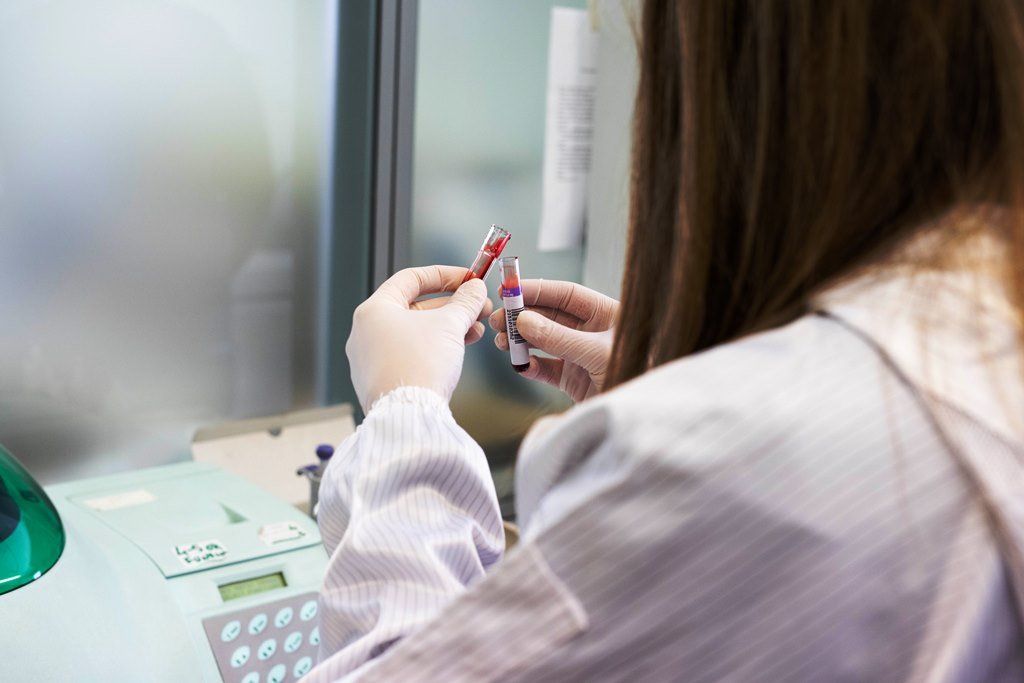 Persona in camice da laboratorio che tiene in mano delle fiale, probabilmente in un ambiente di laboratorio.