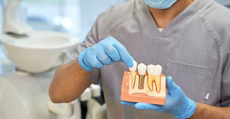 5 Myths About Dental Implants You Should Stop Believing