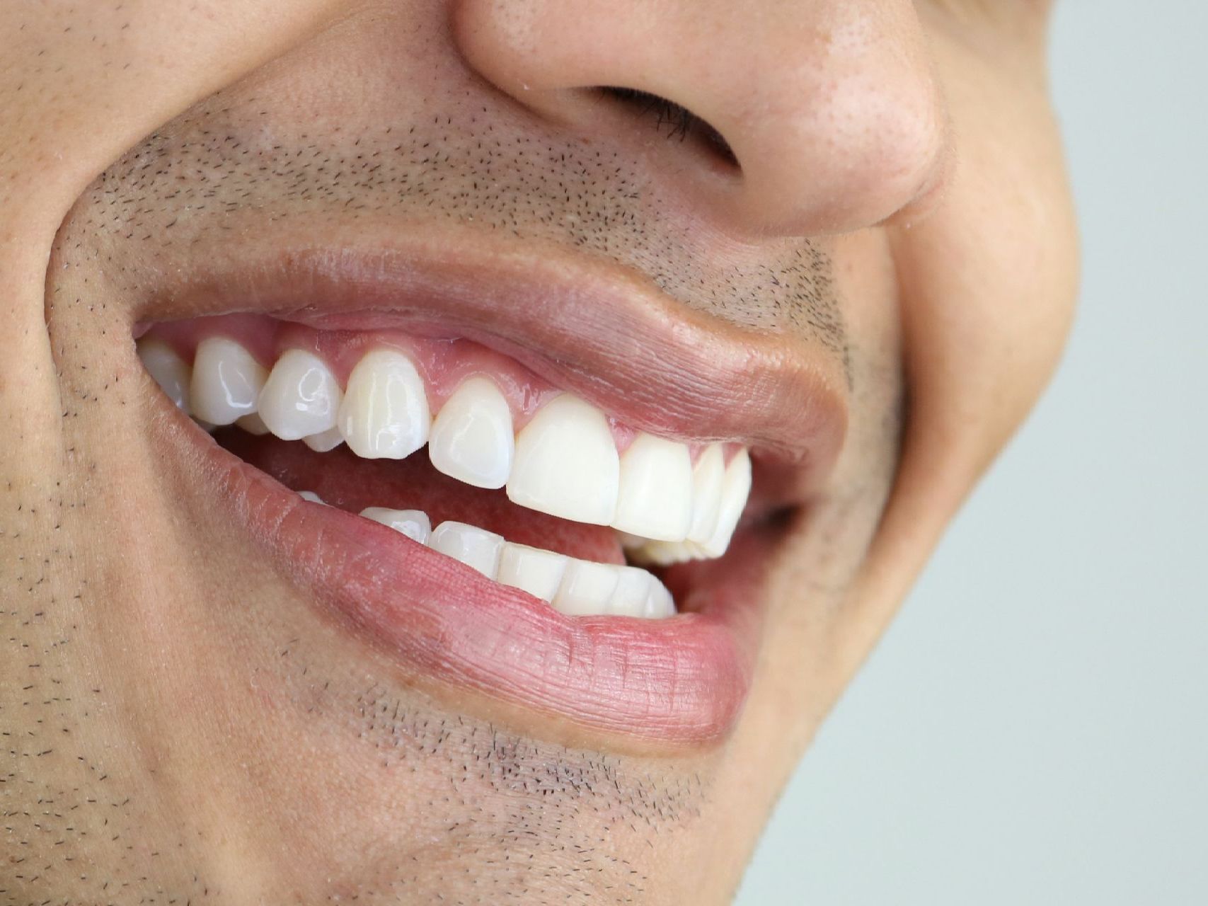 An up close image of a man's smile with straight, white teeth