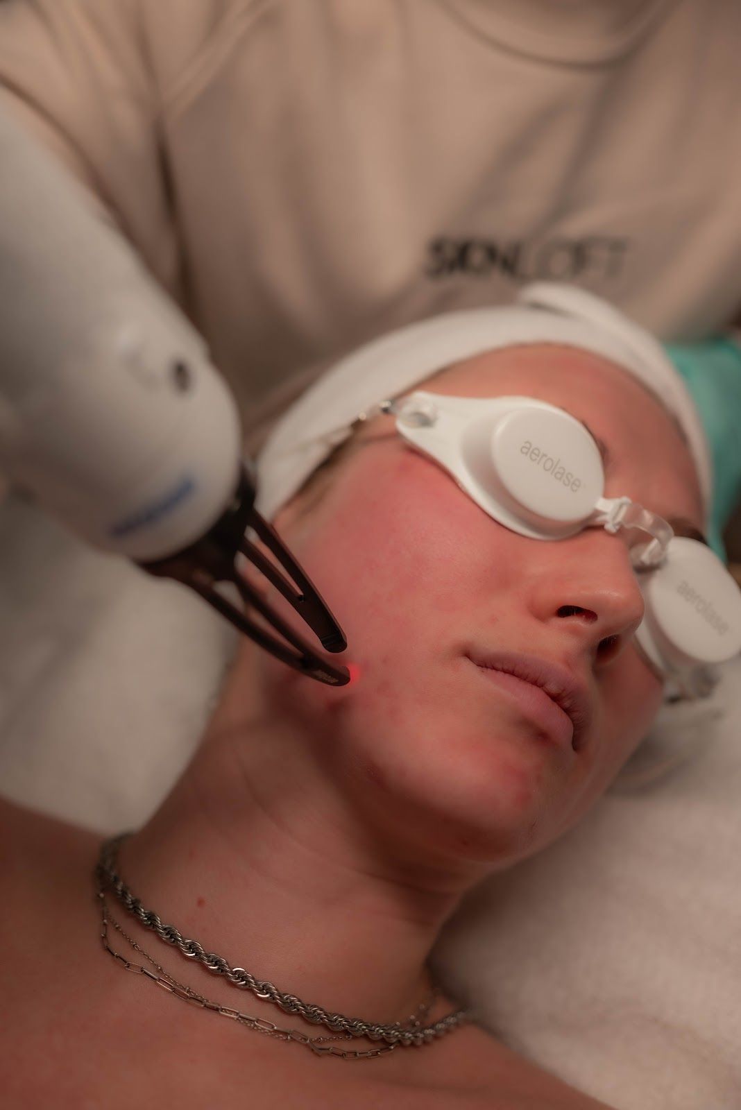 Person undergoing facial laser treatment; red skin, wearing eye protection and a head wrap.