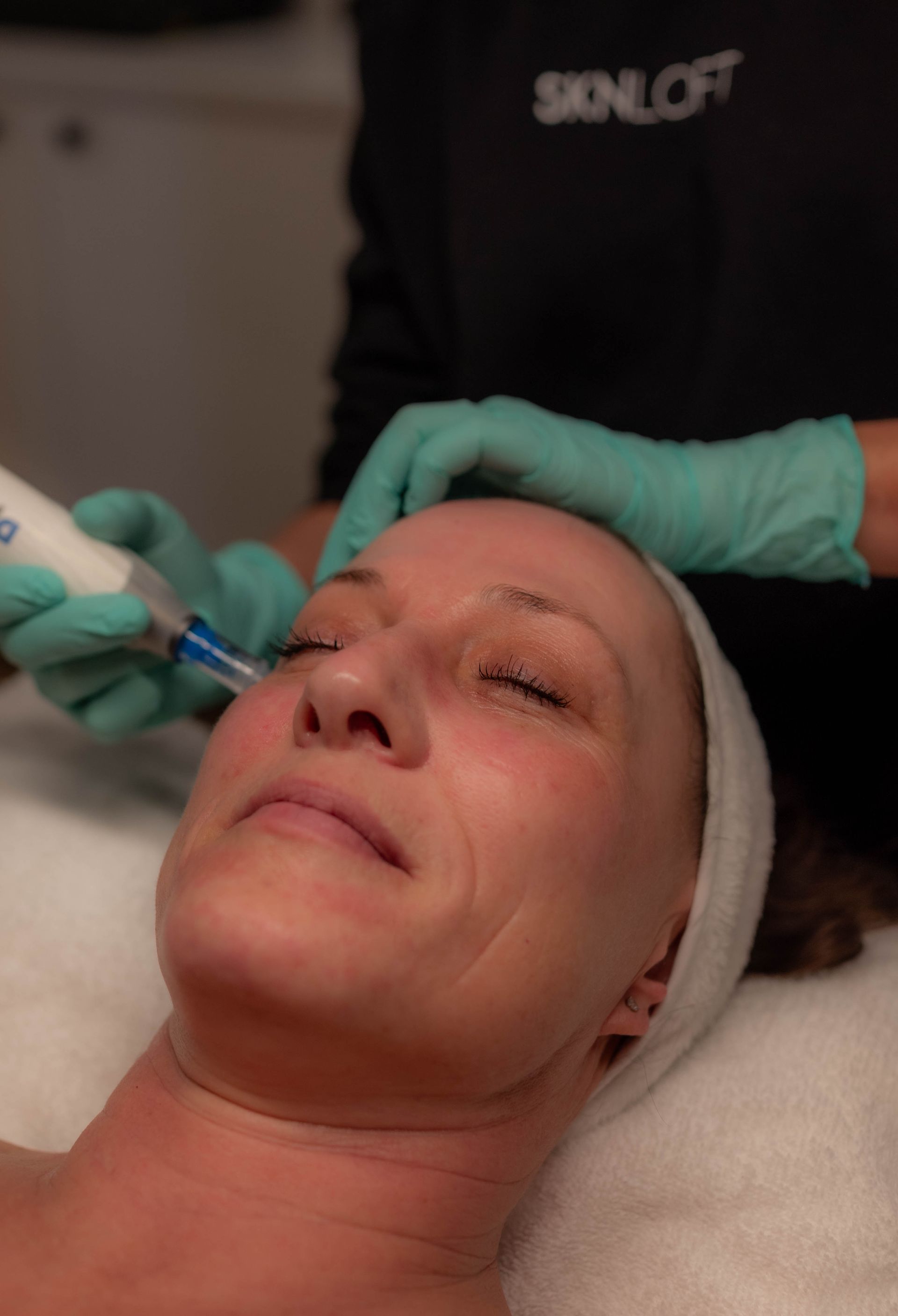 A close up of a person getting a tattoo on their face.