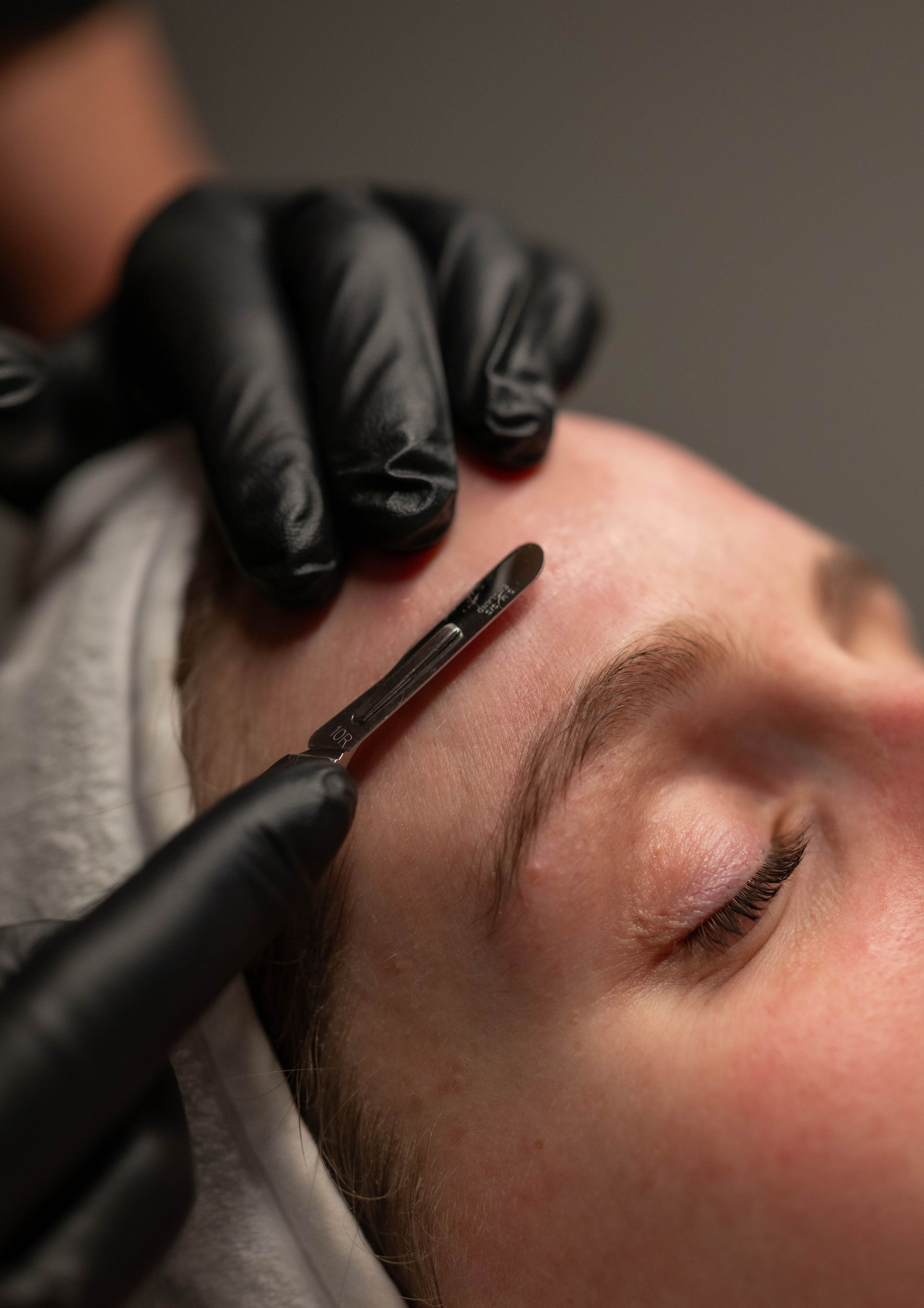 A professional in black gloves uses a dermaplaning tool to exfoliate the skin above a person's eyebrow.