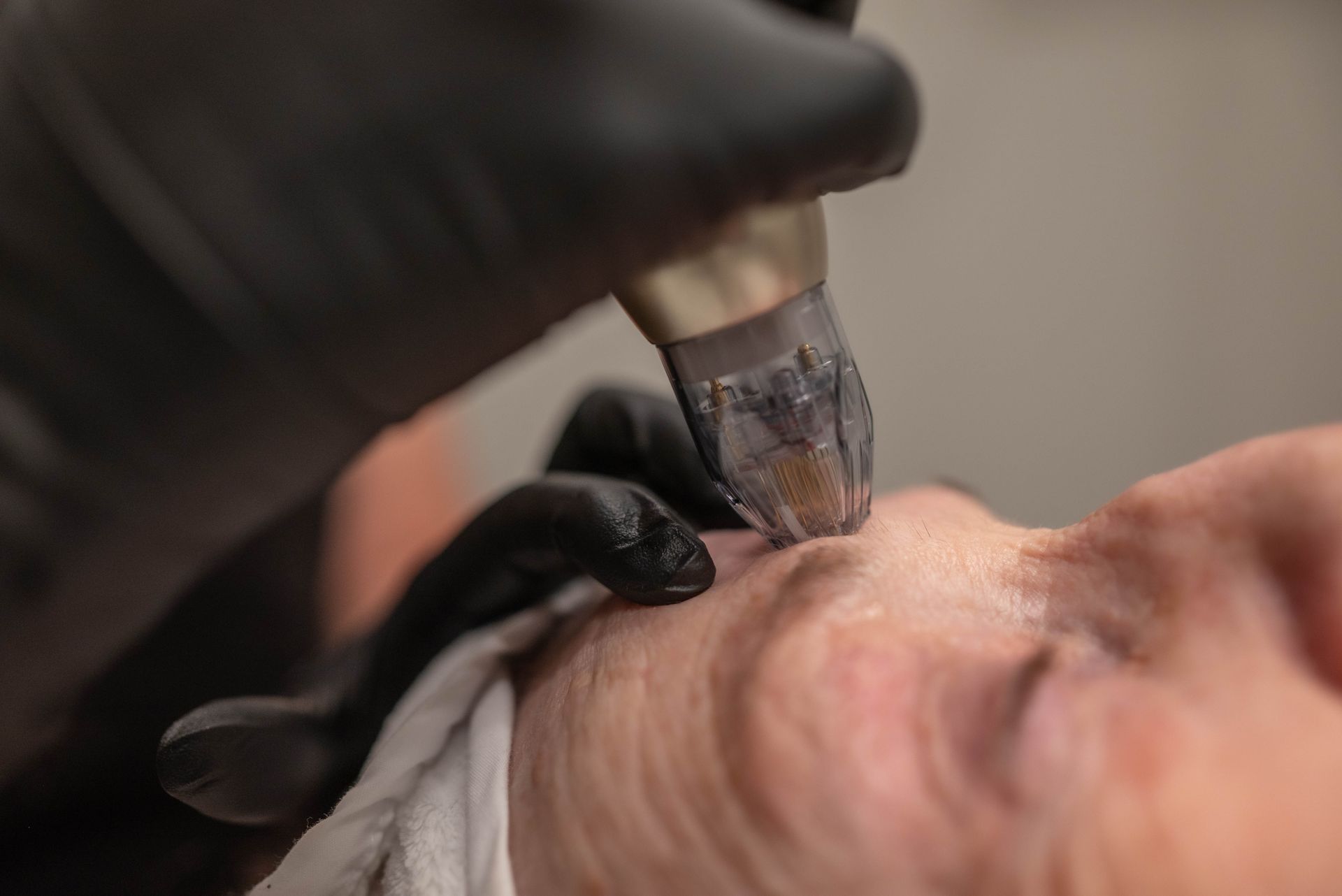 A close up of a person getting a tattoo on their face.