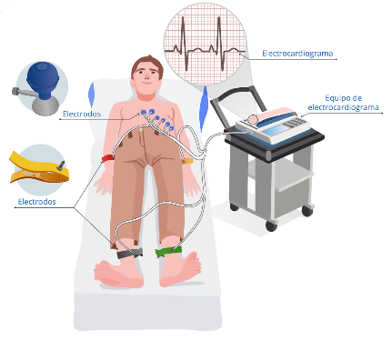 ZAÍN RADIOLOGÍA - Electrocardiograma esquema