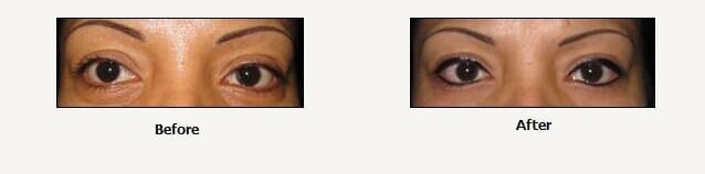 Eye lines before and after — Makeup Salon in Appleton, WI