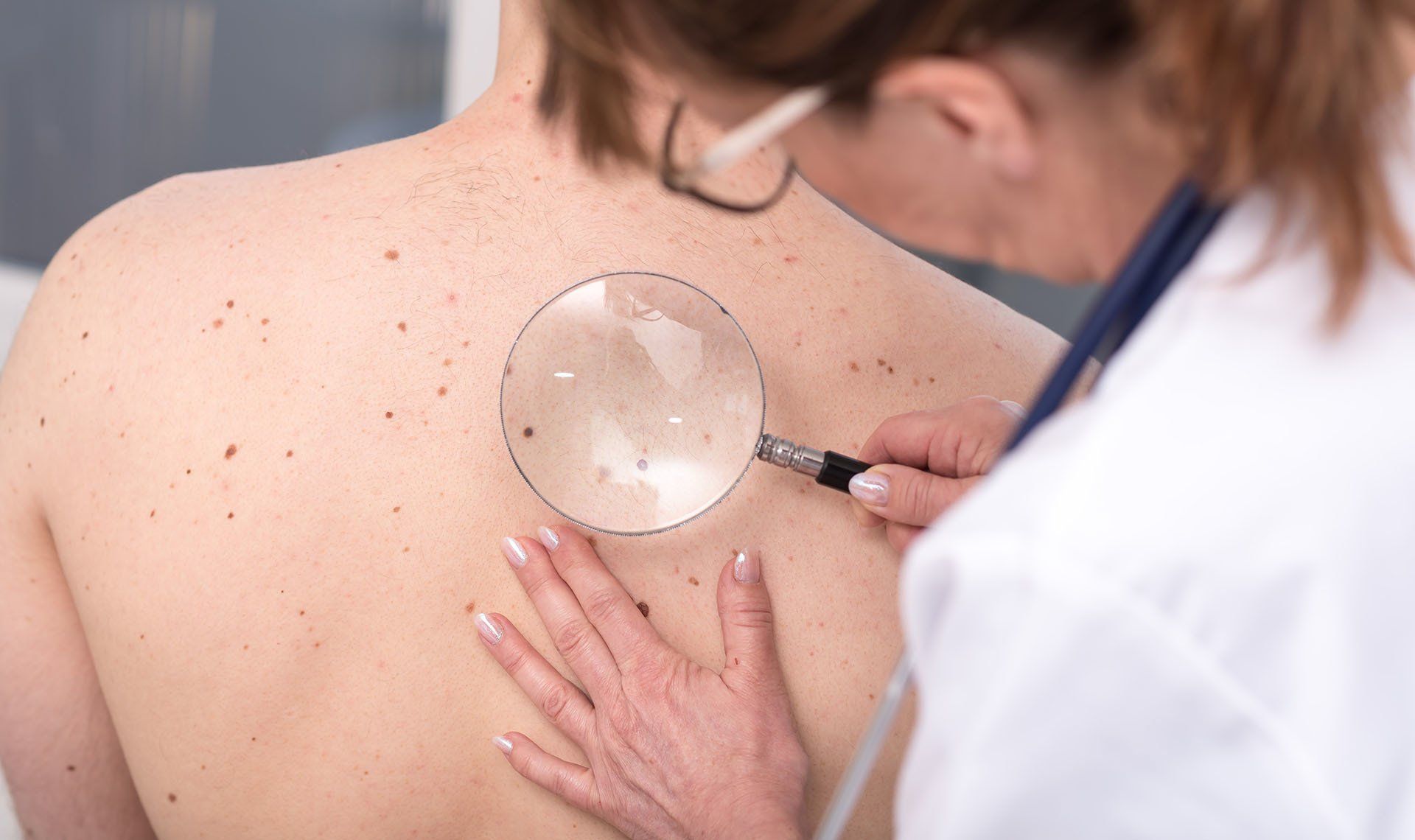 Dermatologist Examining Skin Of A Patient — Watkinsville, GA — Athens Dermatology Group & The Vein Clinic