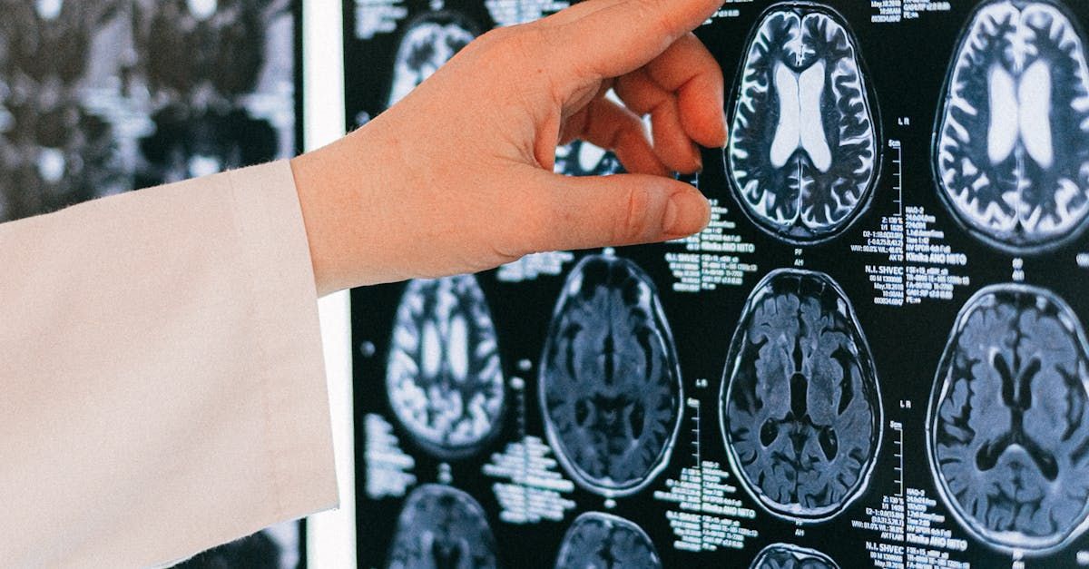 A person is pointing at an x-ray of a brain.