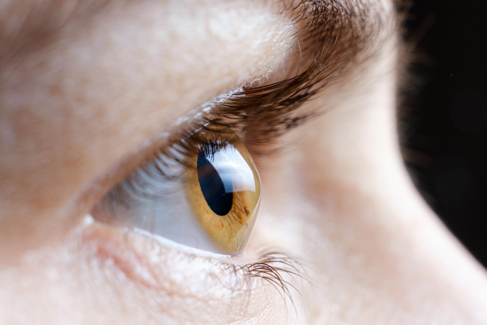 A close up of a woman 's eye with a yellow iris.