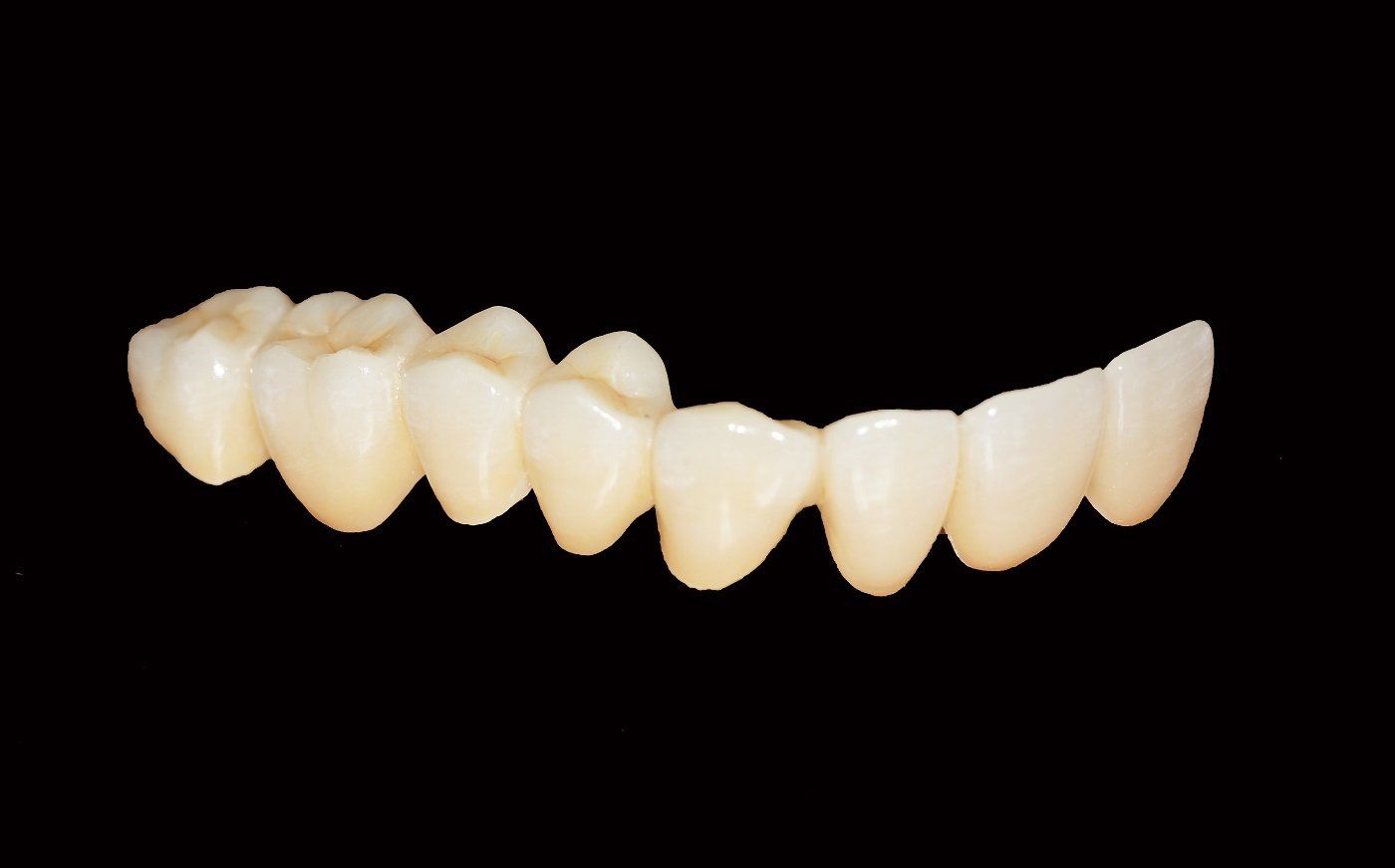 Natural-looking dental crowns