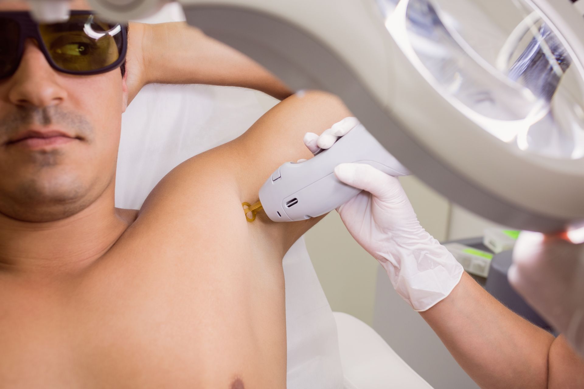 A man is getting a laser hair removal treatment on his underarm.