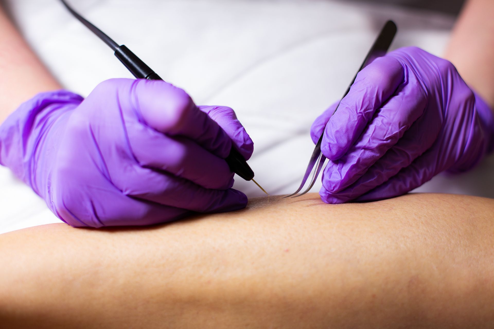 A person wearing purple gloves is using a device on a person 's arm.