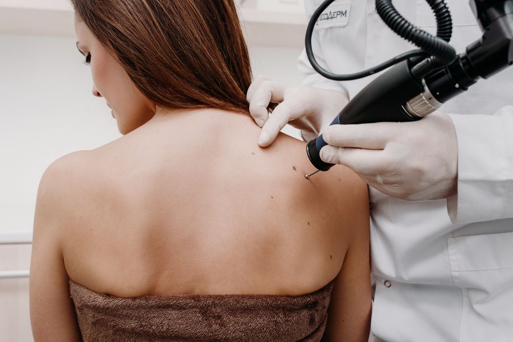 A healthcare provider in a white coat and gloves uses a medical laser device on a spot on a patient's upper back.
