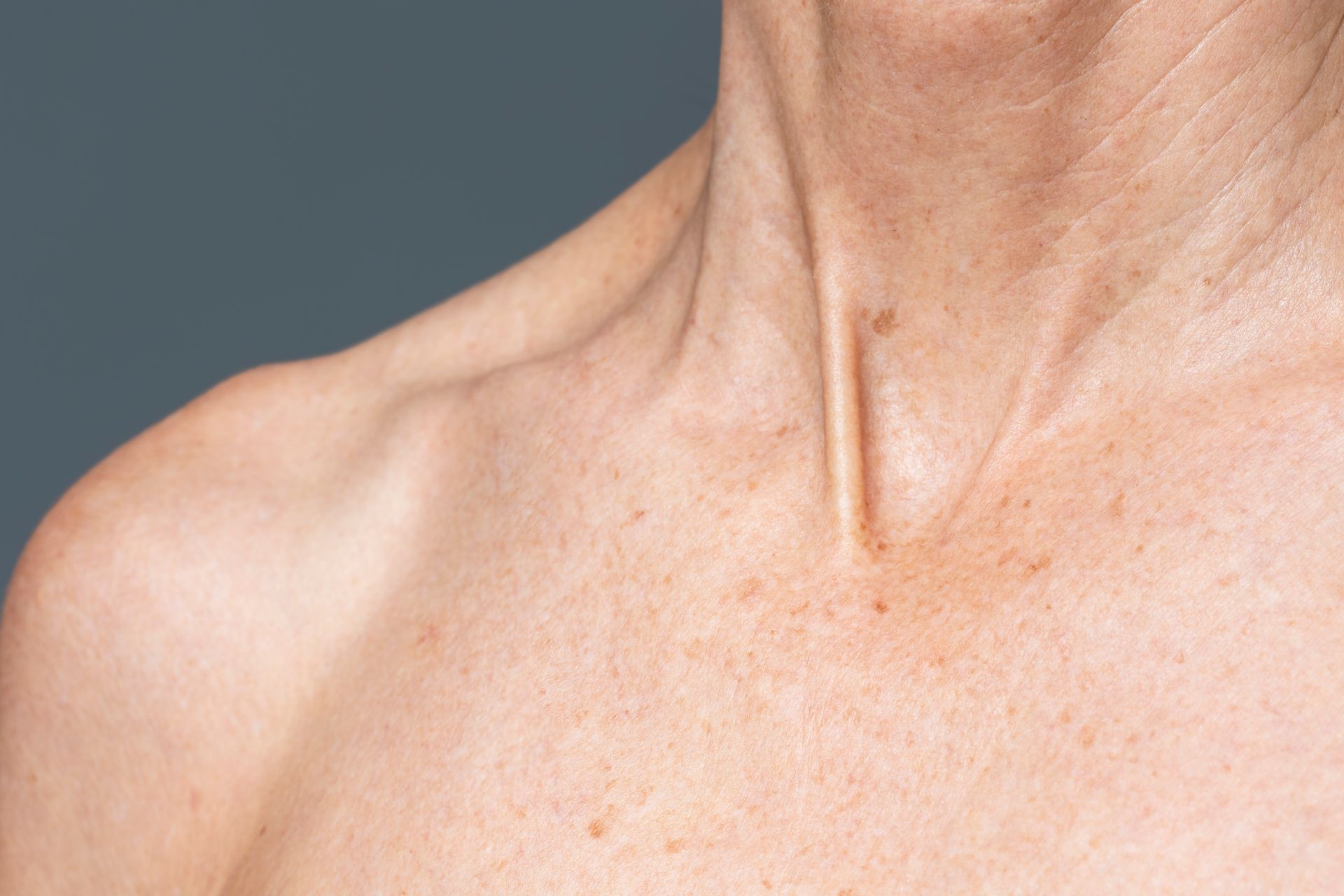 A close up of an older woman 's neck and shoulder.