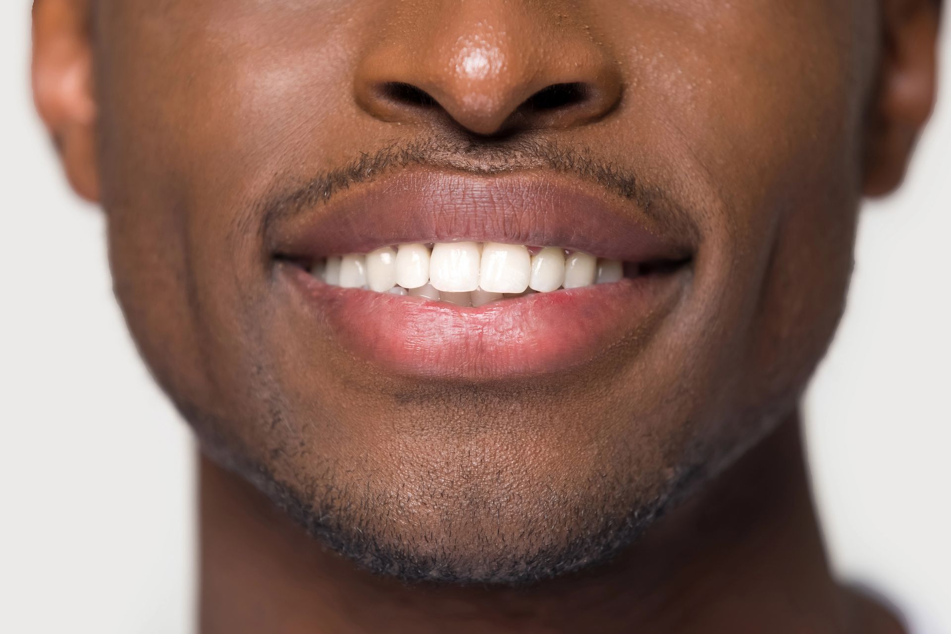 Veneers & Laminates