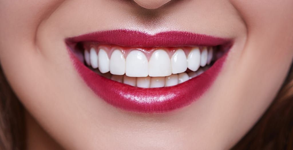 A close up of a woman 's smile with white teeth and red lipstick.