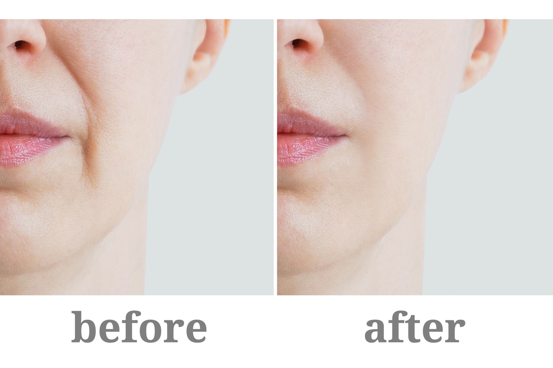 A woman 's face is shown before and after a facial treatment.