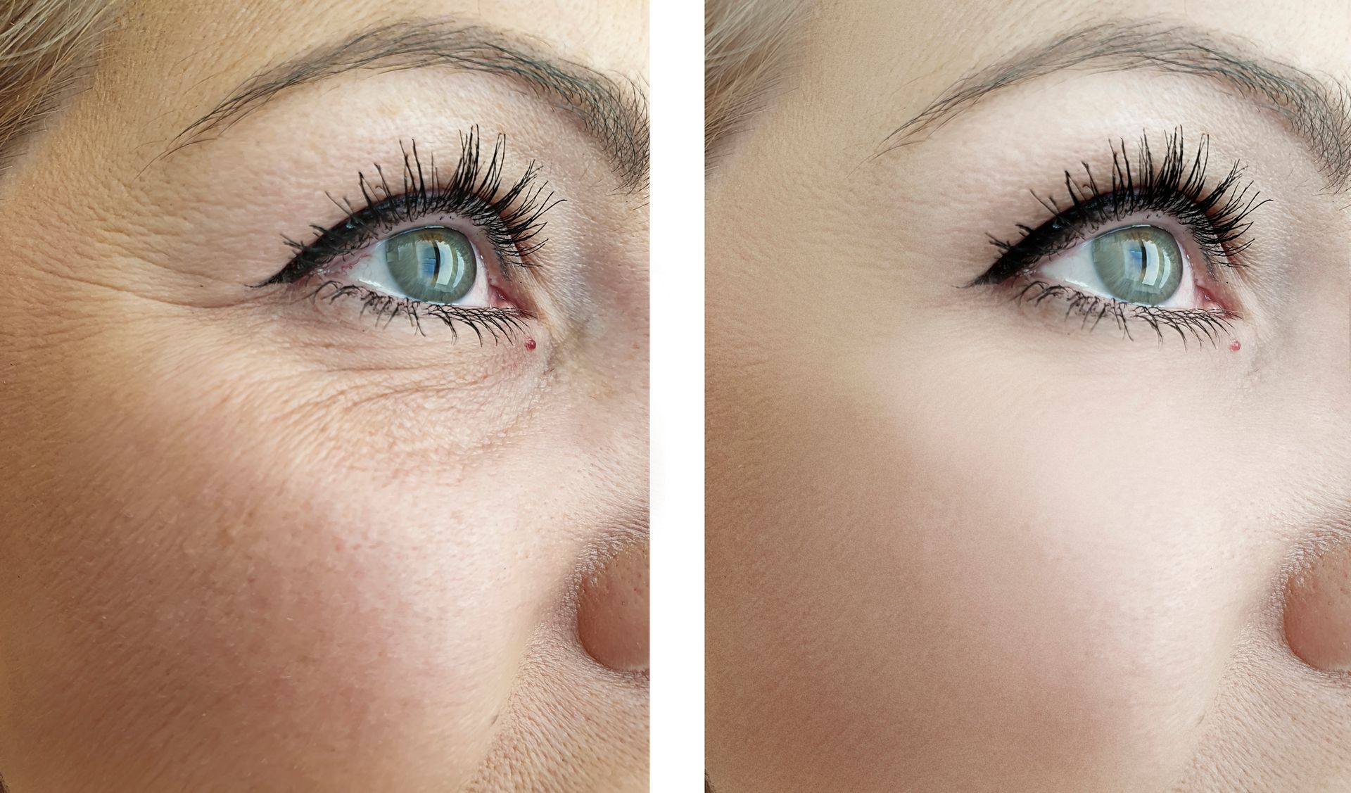 A before and after picture of a woman 's lips with arrows pointing in different directions.