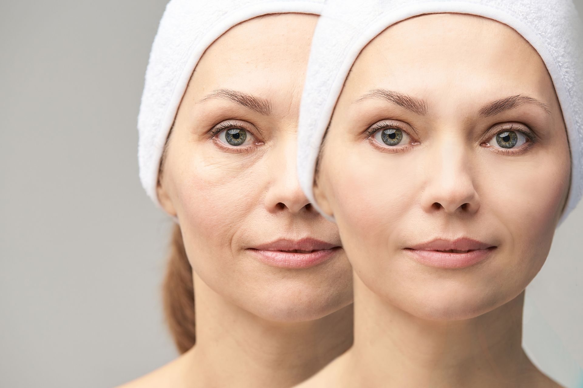 A woman 's face is shown before and after a facial treatment.