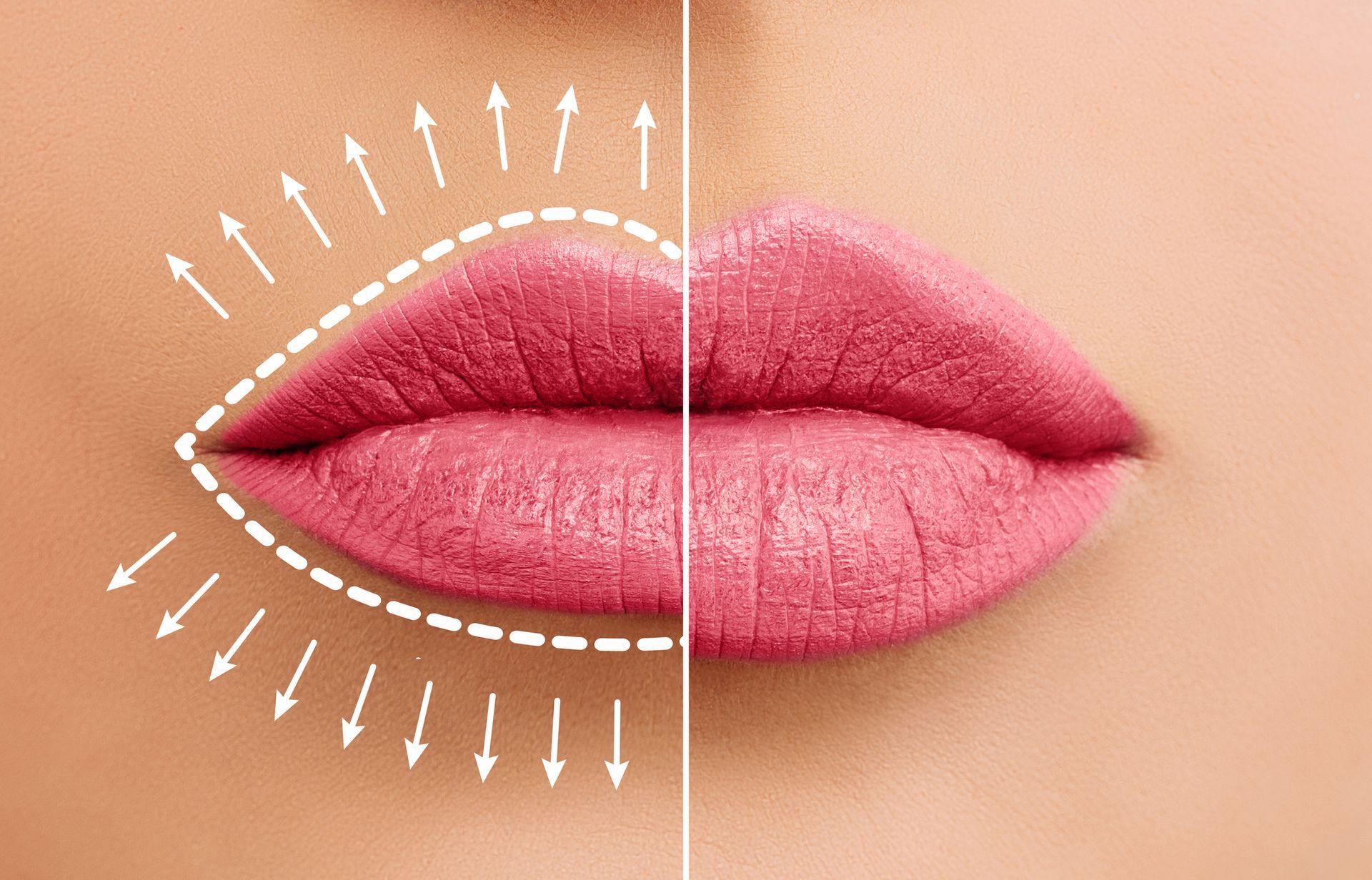 A before and after picture of a woman 's lips with arrows pointing in different directions.