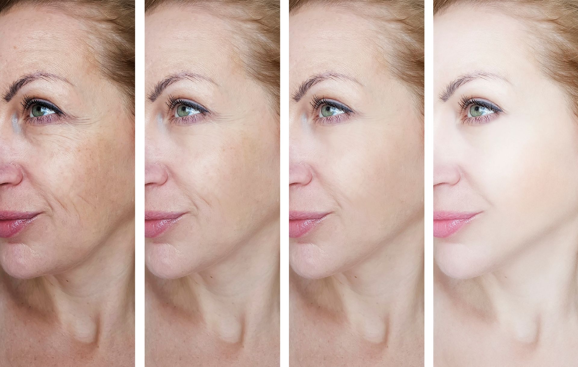 A woman 's face is shown before and after a facial treatment.