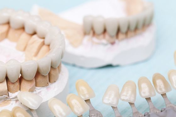 trattamenti dentali e interventi di chirurgia dentale a Napoli