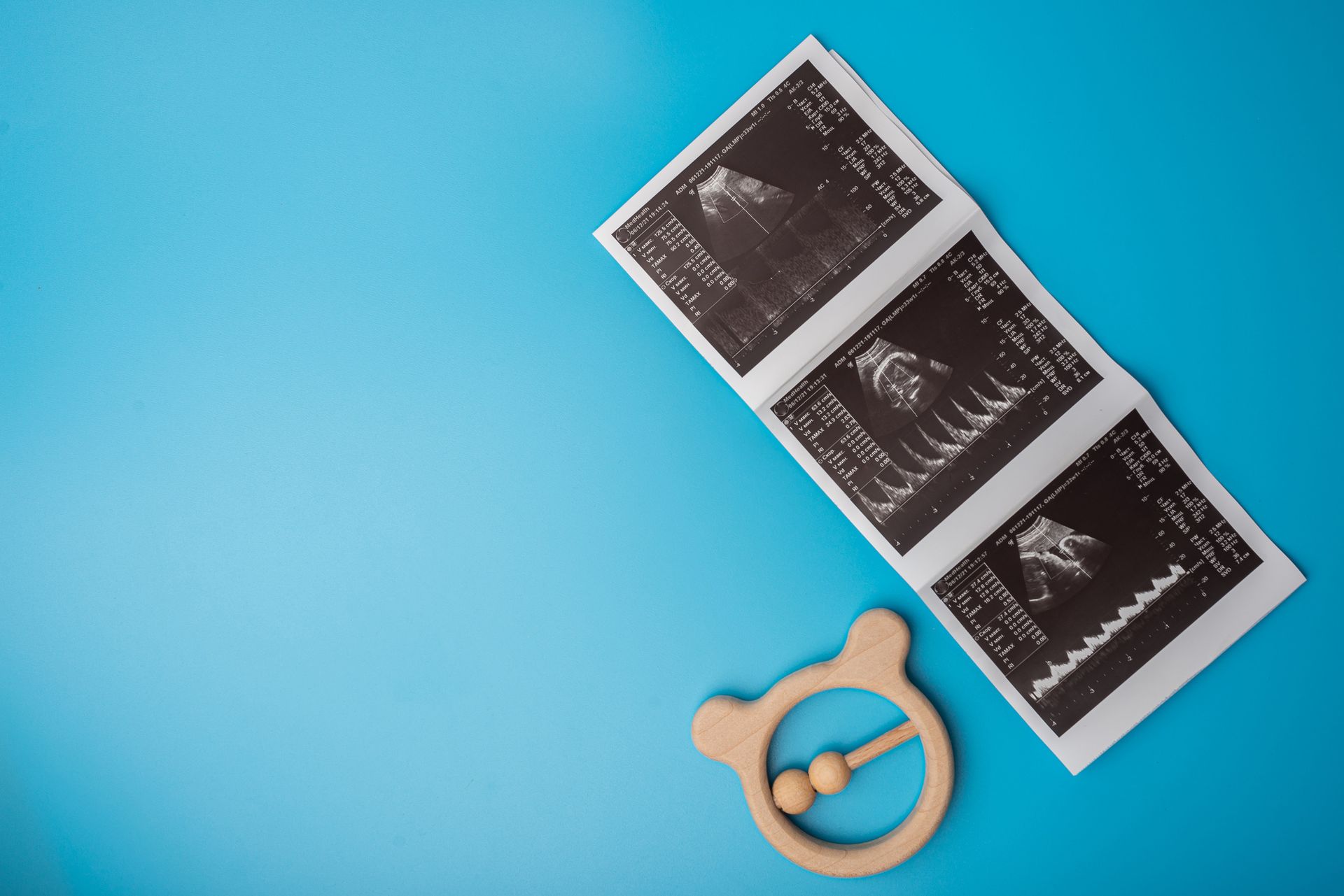 Discover the Benefits of 3D and 4D Ultrasounds During Pregnancy
