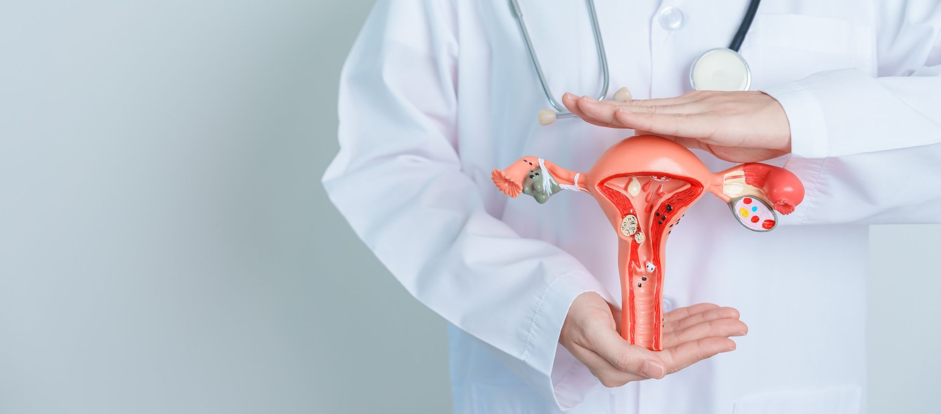 Understanding PCOS and Its Hormonal Impacts on Weight