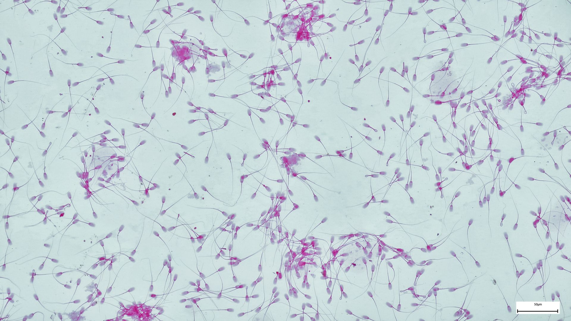 Esame Computerizzato del Liquido Seminale con Apparecchiatura Lenshooke della Bonraybio: Precisione 