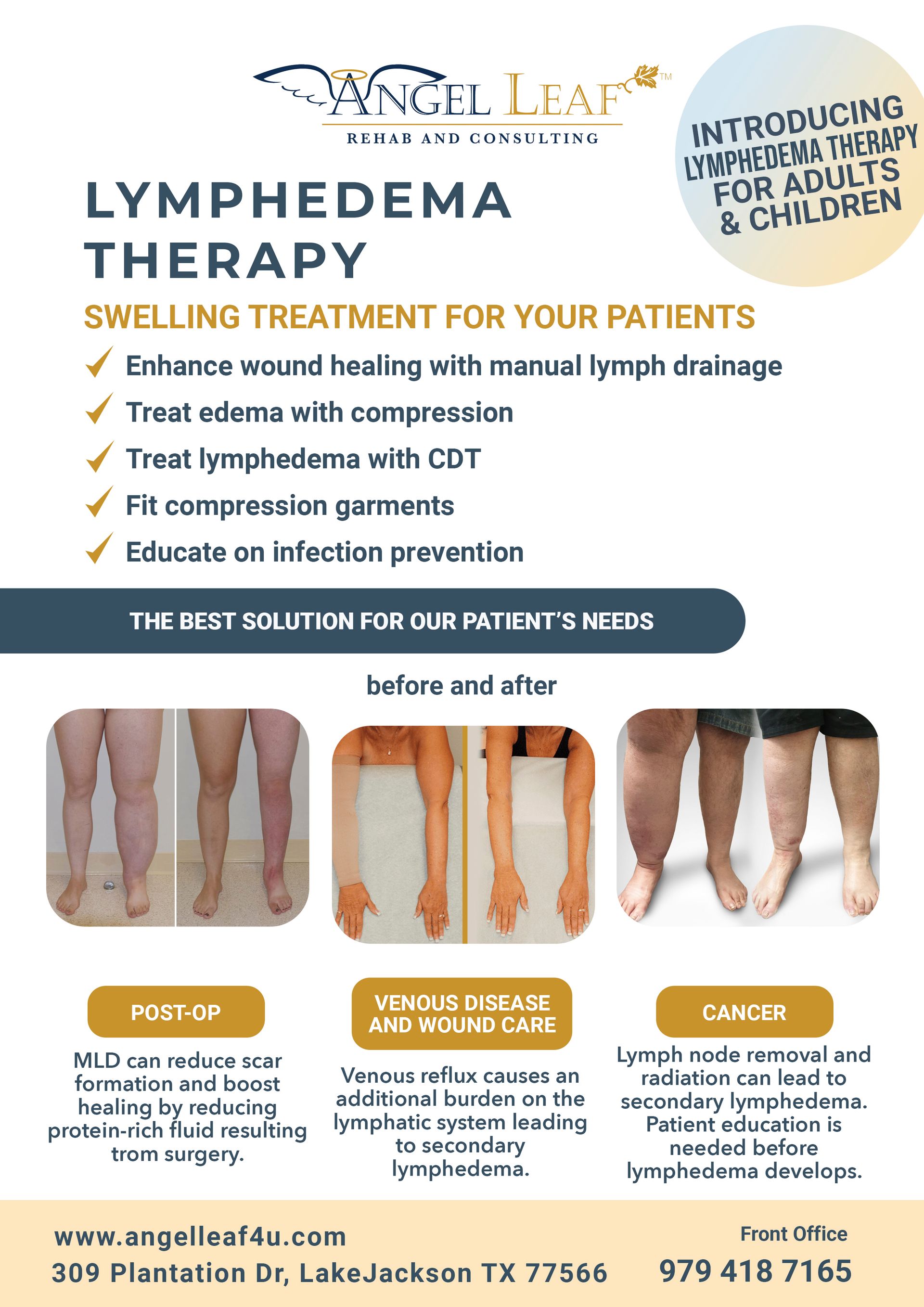 A flyer for lymphedema therapy swelling treatment for your patients.