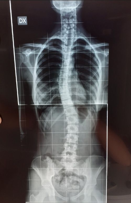 L'ozonoterapia è un potente virucida