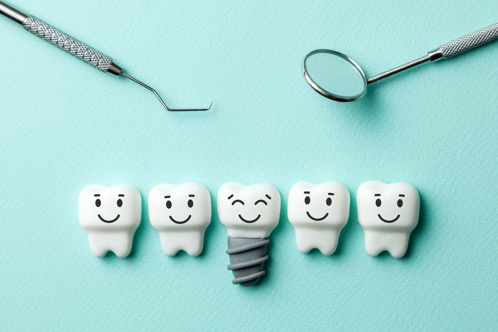 Is It Better to Get a Dental Implant or a Bridge?