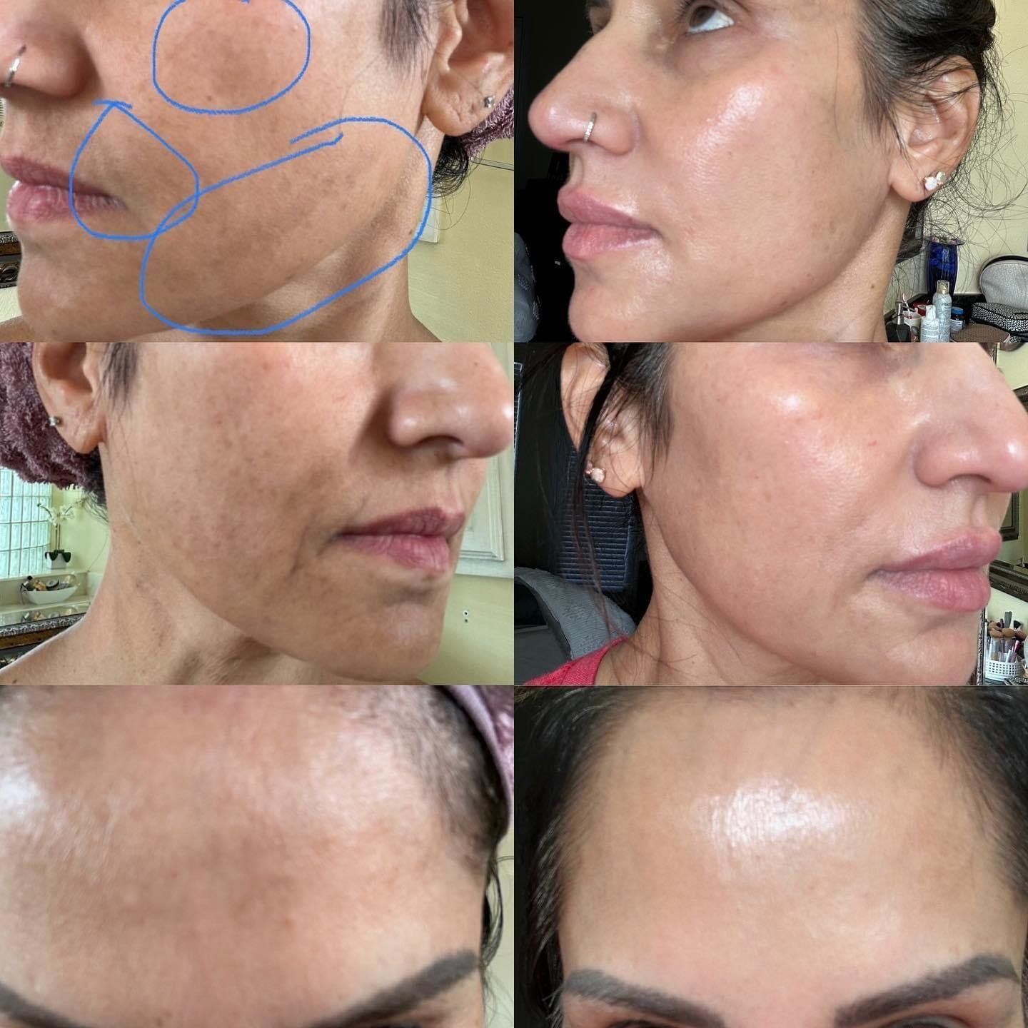 Sim’s Melasma Cream
