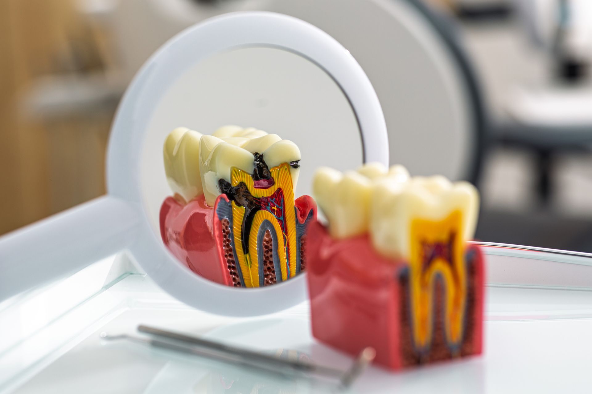 Tooth model with cavity reflected in a dental mirror, with dental tools in view. Tooth model with cavity reflected in a dental mirror, with dental tools in view.