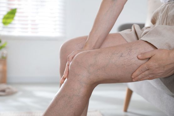 Person seated, examining their leg, which has visible veins. Indoor setting, natural light.