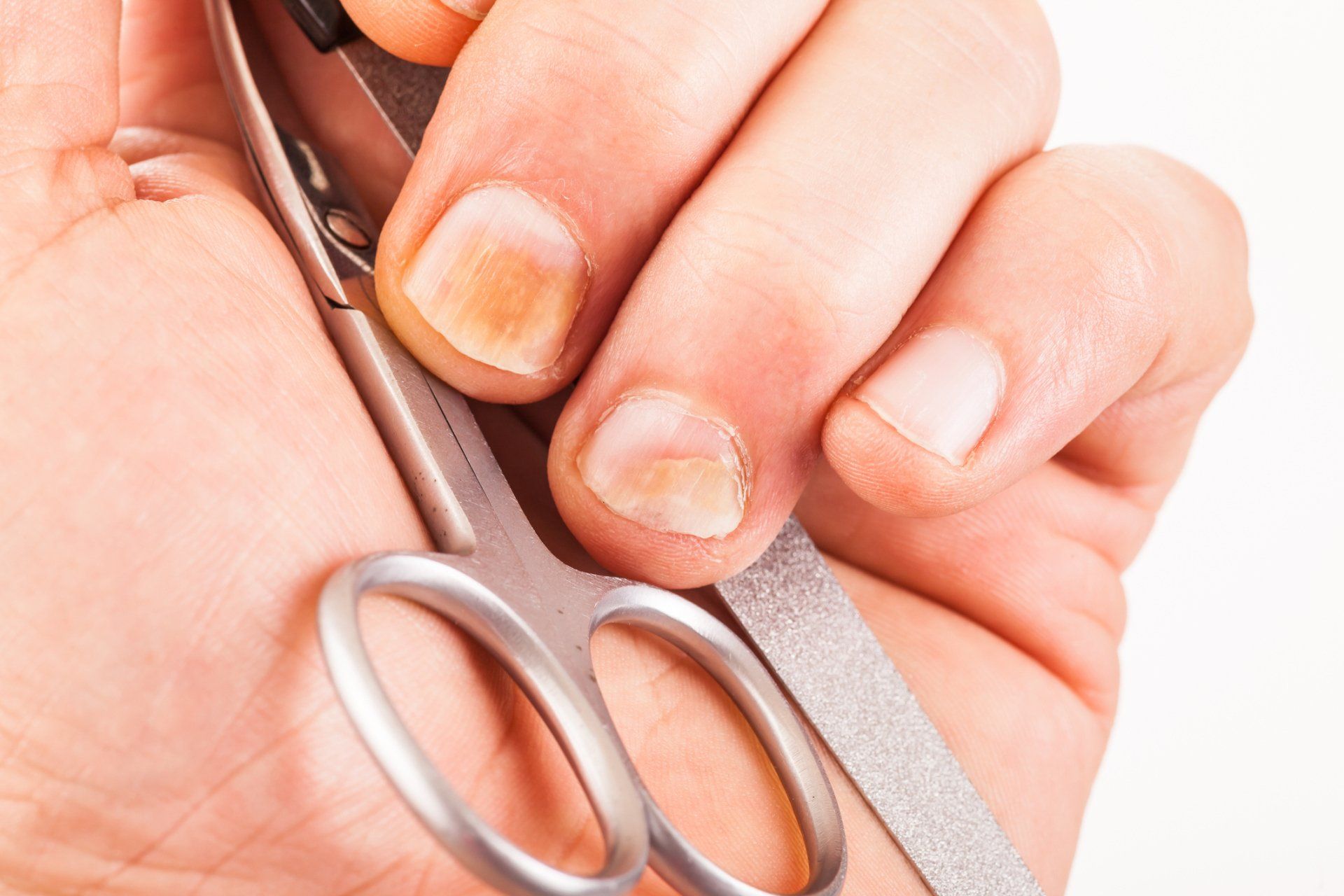 Проблема с ногтями к какому врачу обратиться