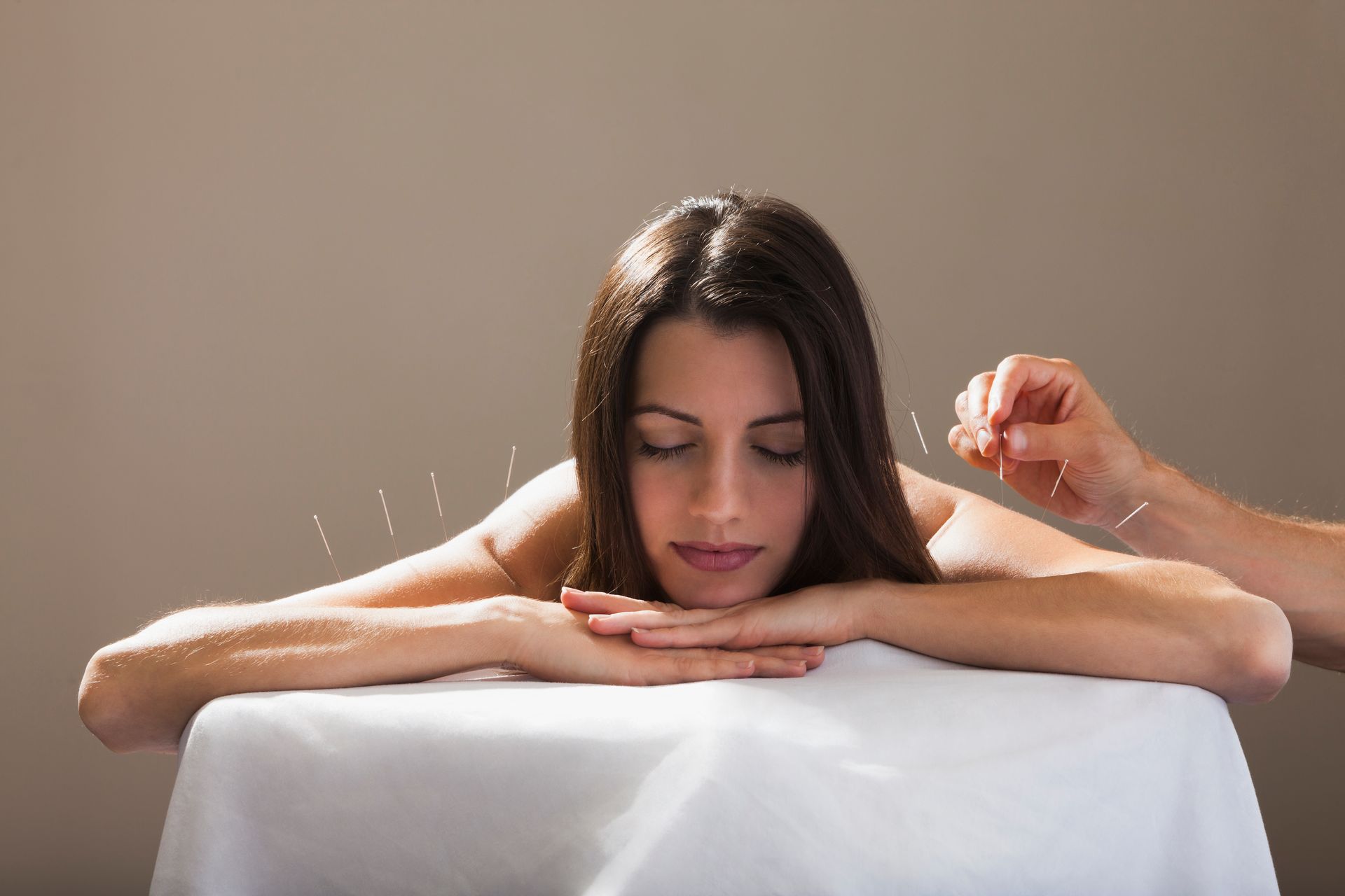 Woman Getting Acupuncture — Salina, KS — Schwedtfager Chiropractic