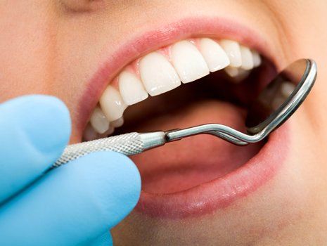 Teeth Whitening — Dentist Checking the Teeth Using Dental Mirror in Brownsburg, IN