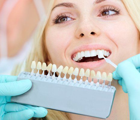 Veneers — Closeup of a Girl Smiling at the Dentist in Brownsburg, IN