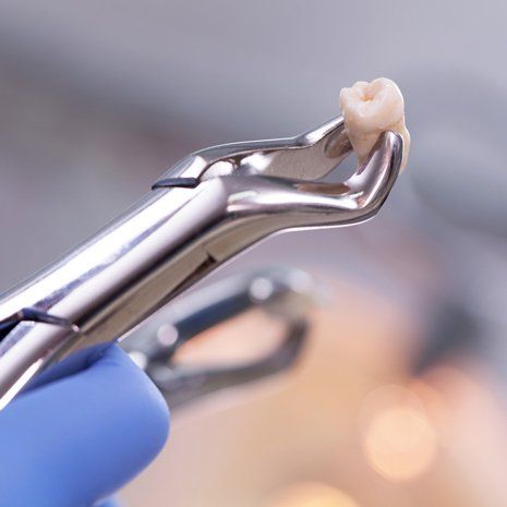 Tooth Extractions — Tooth Extracted Using Dental Equipment in Brownsburg, IN