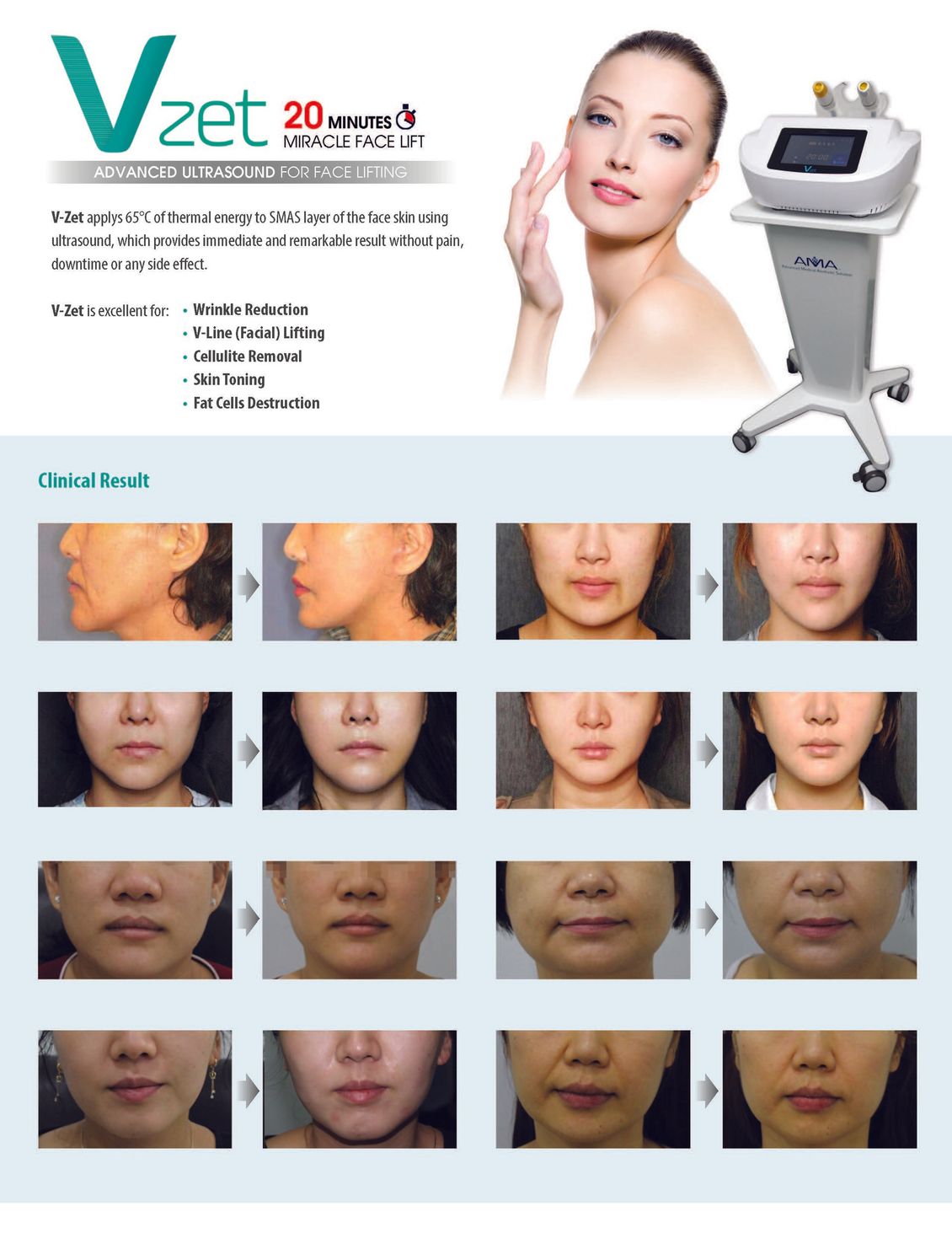 New Facial Treatment — Facial Result Table in Cerritos, CA