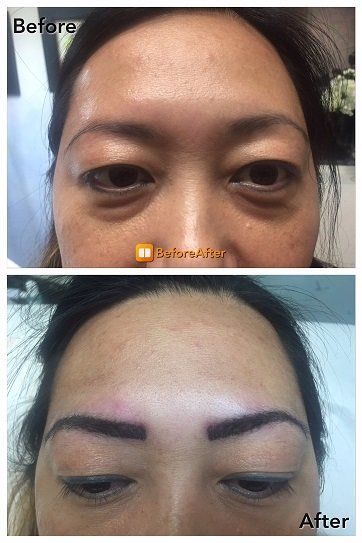Permanent Eye Brows — Eye Brow Treatment in Cerritos, CA
