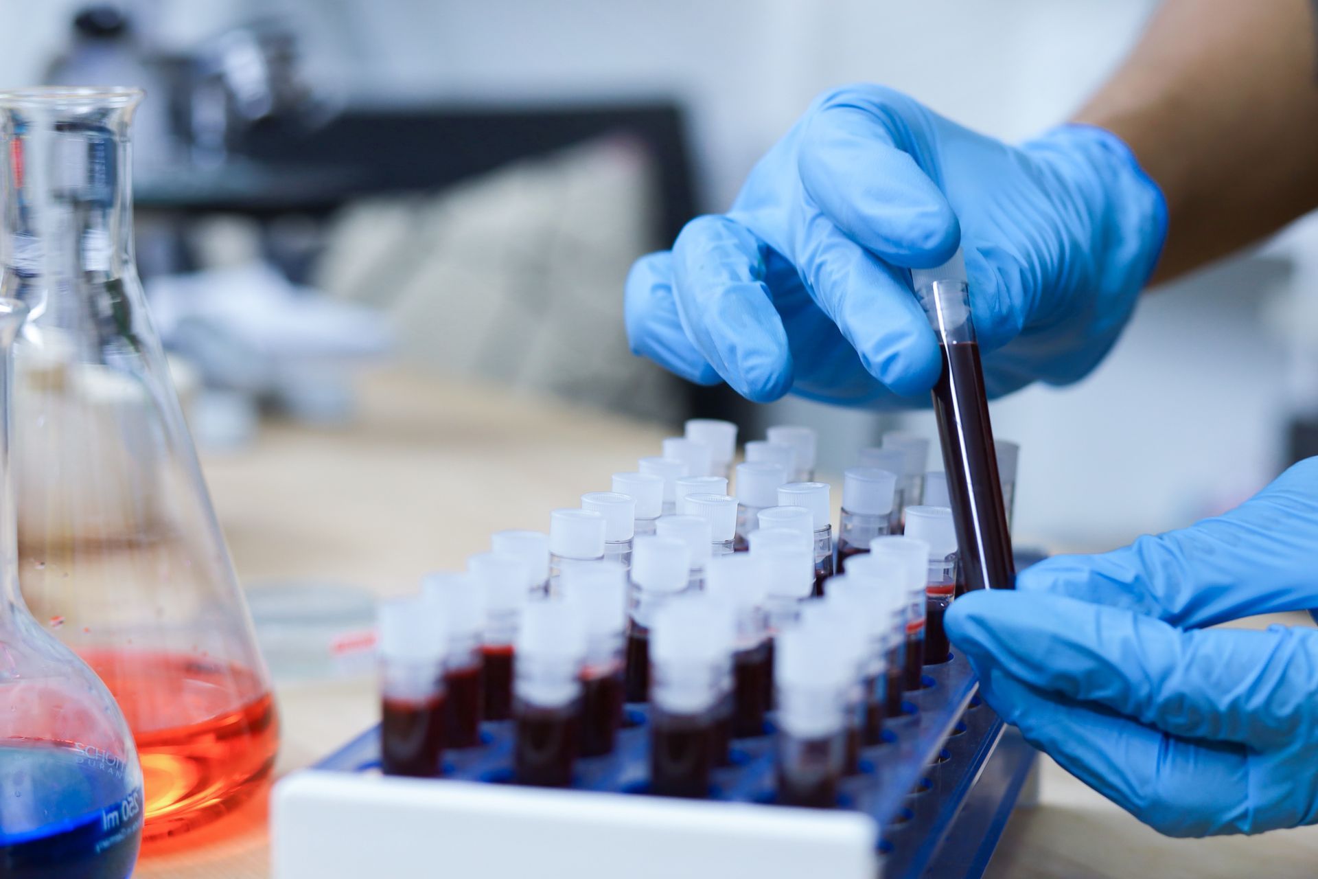 Scientist in blue gloves holding a blood sample in a lab, with test tubes and flasks in the background.